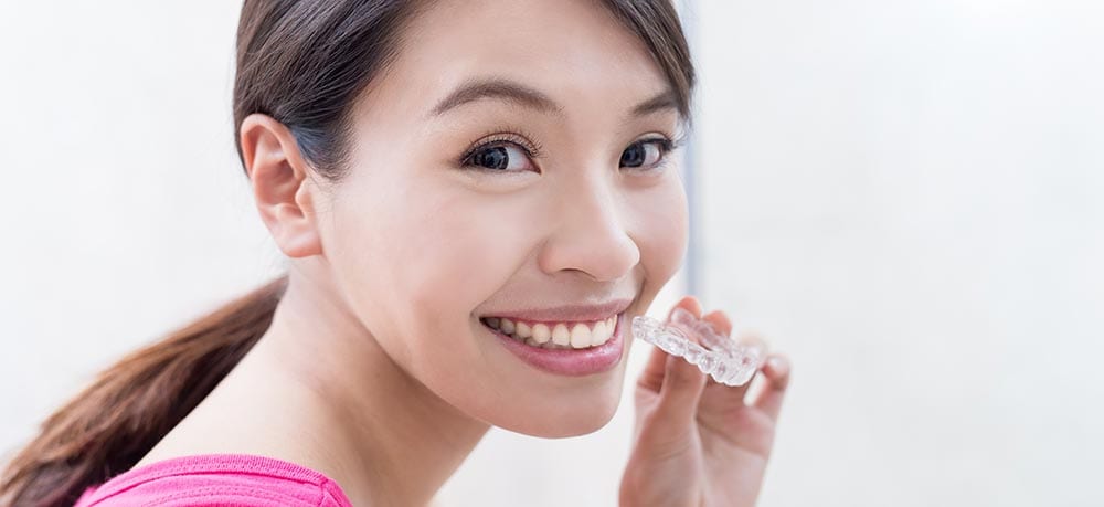 Clear Aligners Myths & Facts